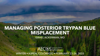 Managing posterior trypan blue misplacement